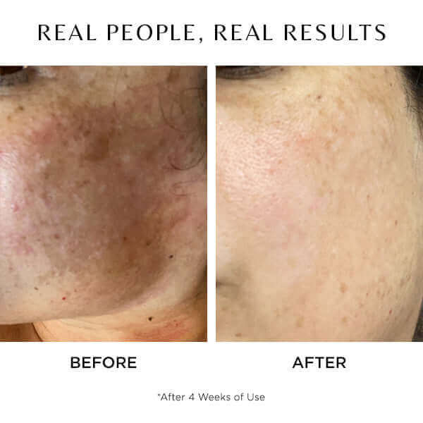 A before and after of using revert for 4 weeks 