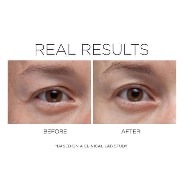 Before and After results of a clinical lab study on the Opti-Crystal eye cream