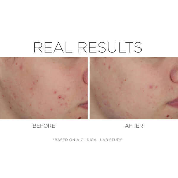 Before and after results of a someone using Shineless based in a clinical lab study